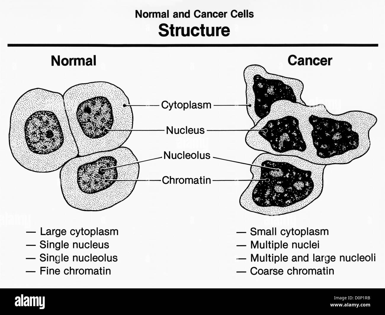 Eine künstlerische Interpretation Struktur normalen Zellen Krebszellen zeigt beide Merkmale. Krebszellen Exhibt erhöht, sondern Stockfoto