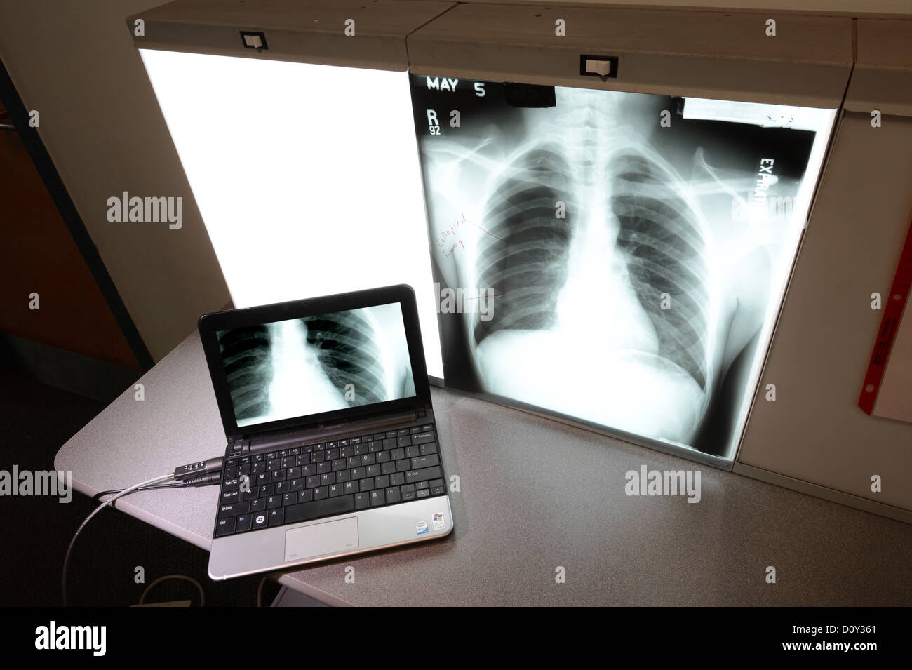 Röntgen-Thorax & Computer, Ärzte Büro, USA Stockfoto