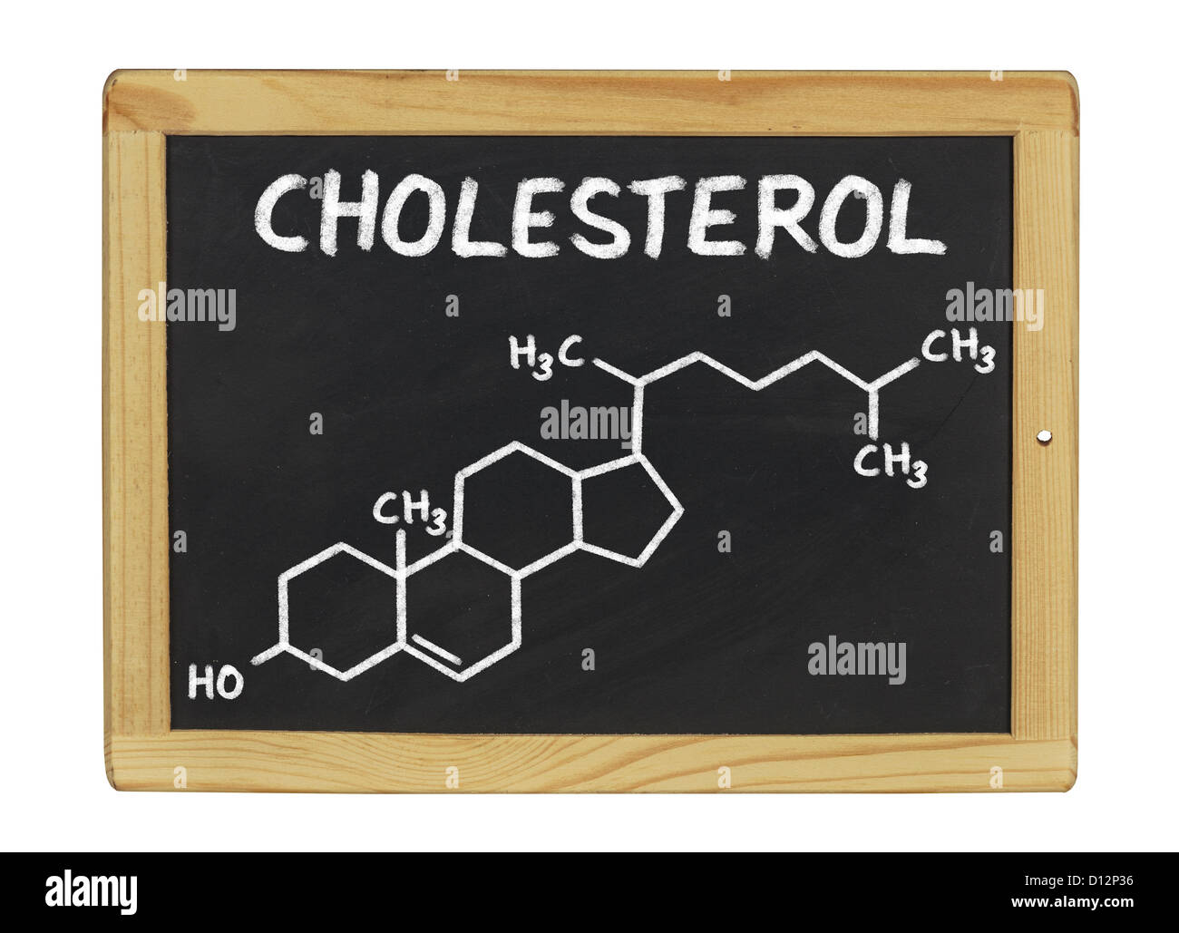 chemische Formel des Cholesterins auf einer Tafel Stockfoto