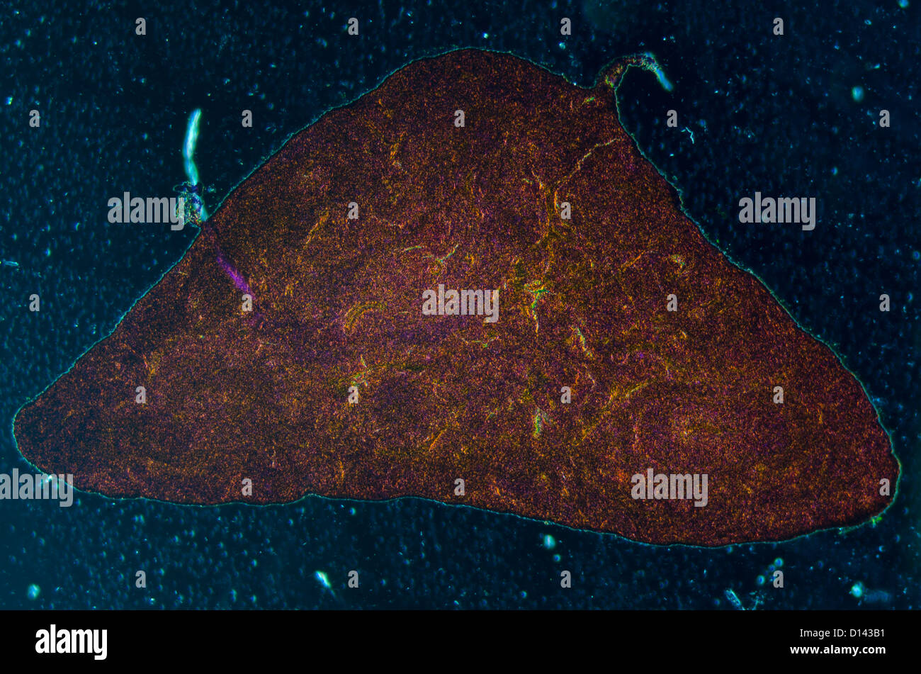 Schliffbild der Bauchspeicheldrüse Gewebe, typische Bauchspeicheldrüsen-Gewebe im Jejunum Gewebe Stockfoto