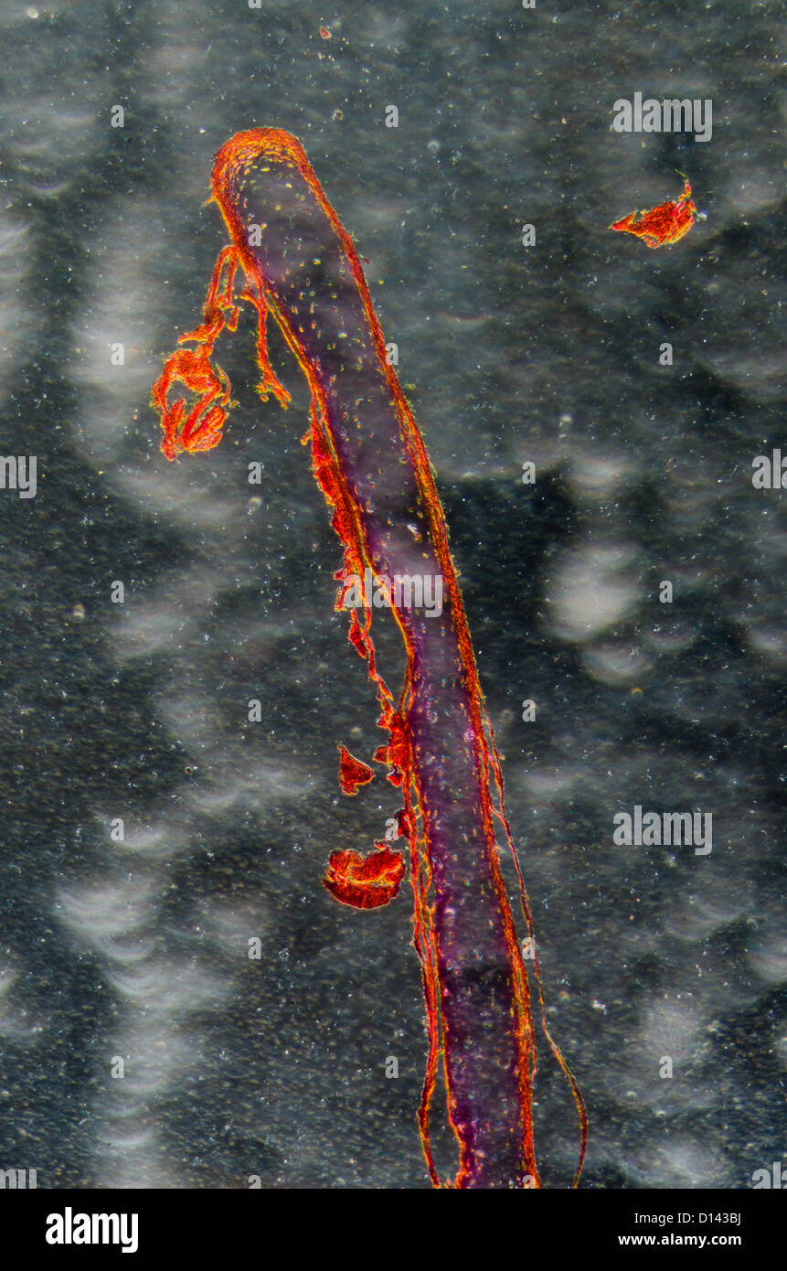 Wissenschaft-Schliffbild der Knochen Zelle osteocyte Stockfoto