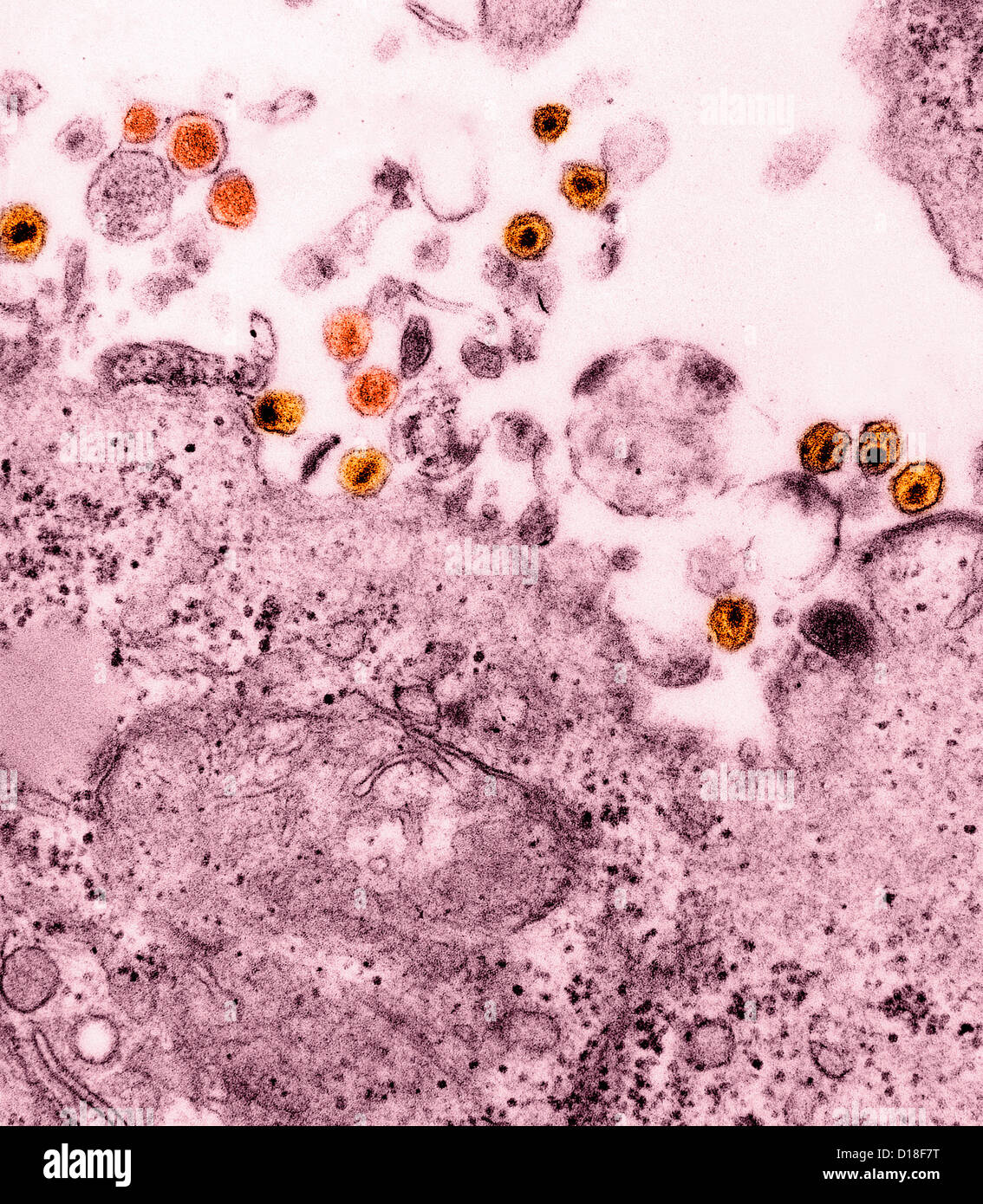 Transmission Electron Schliffbild HTLV und HIV Stockfoto