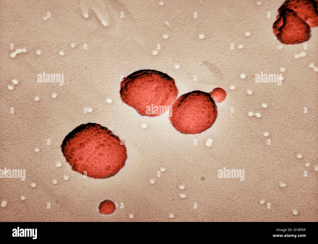 Elektron Schliffbild von Streptococcus pneumoniae Stockfoto
