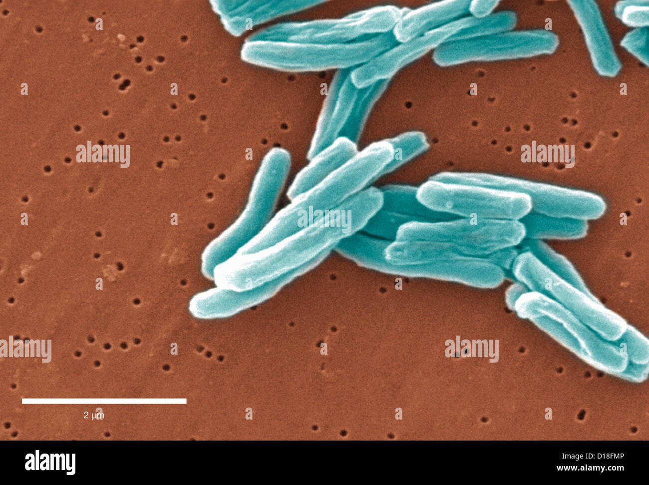 Elektron Schliffbild von Mycobacterium tuberculosis Stockfoto