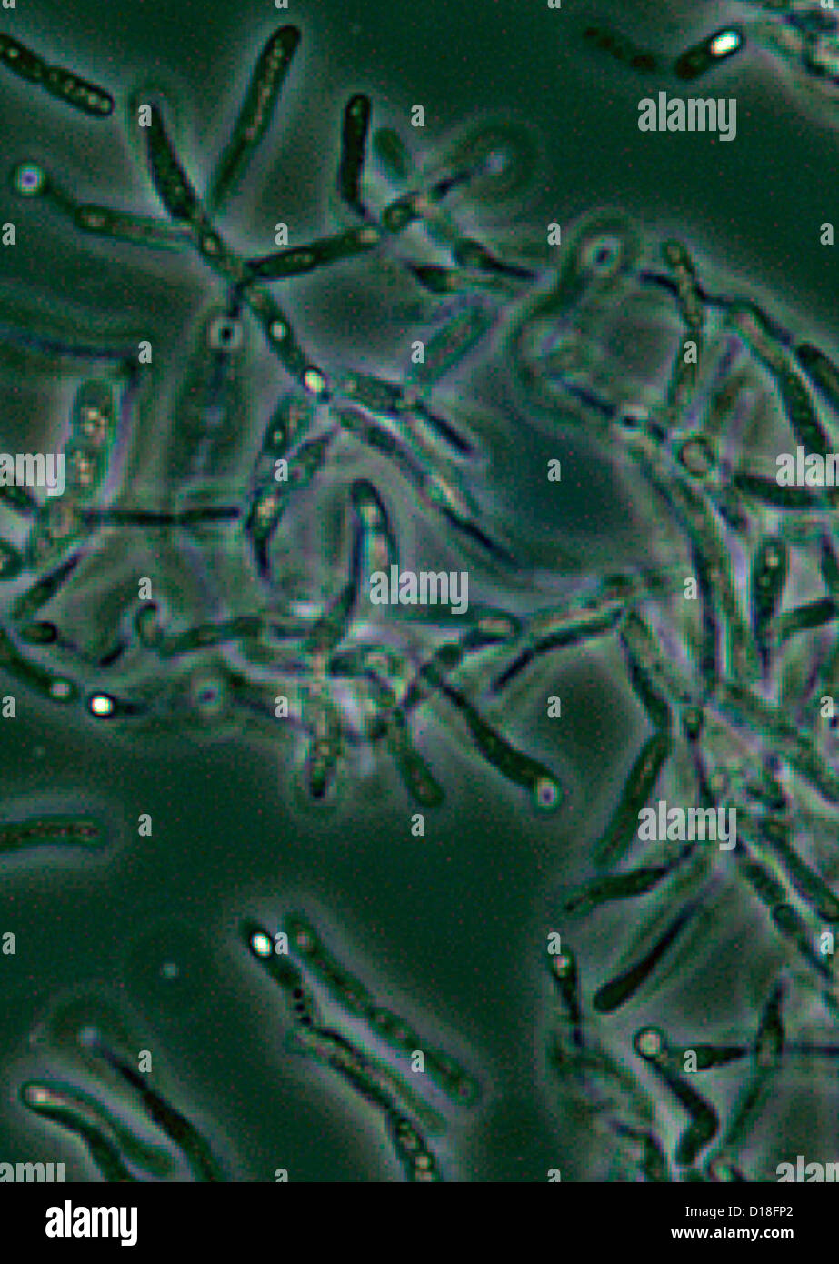 Mikrophotographie von Bacillus Anthracis Sporen Stockfoto