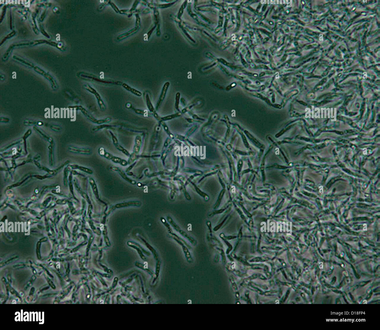 Mikrophotographie von Bacillus Anthracis Sporen Stockfoto