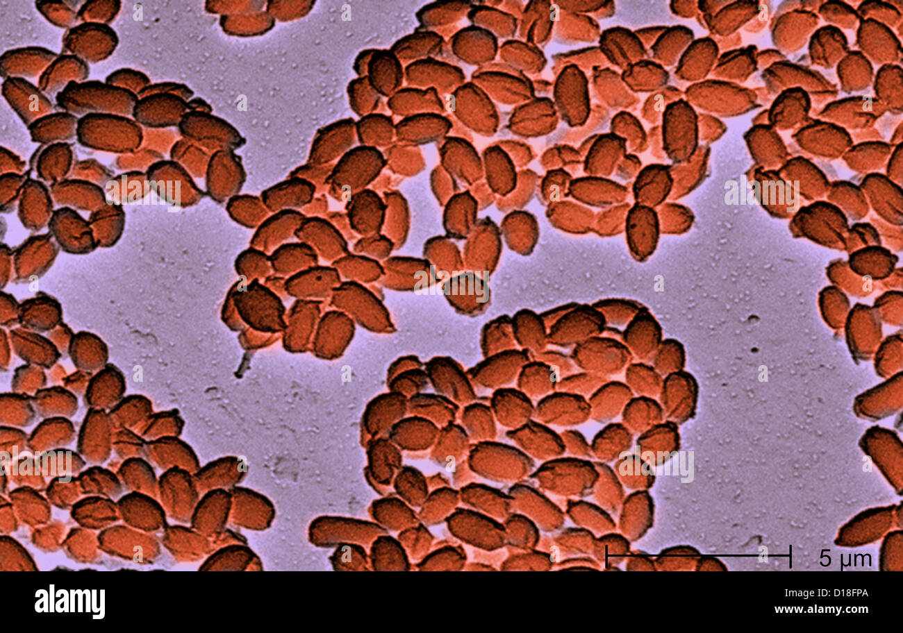 Elektron Schliffbild von Anthrax-Sporen Stockfoto