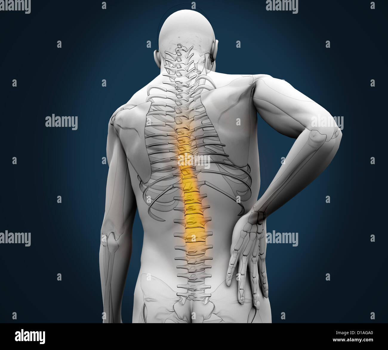 Digitalen Skelett mit Schmerzen auf dem Rücken Stockfoto