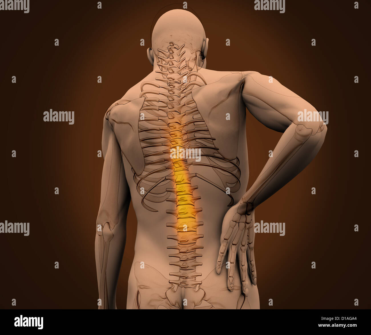 Digitalen Skelett hervorgehoben haben Schmerzen am Rücken Stockfoto