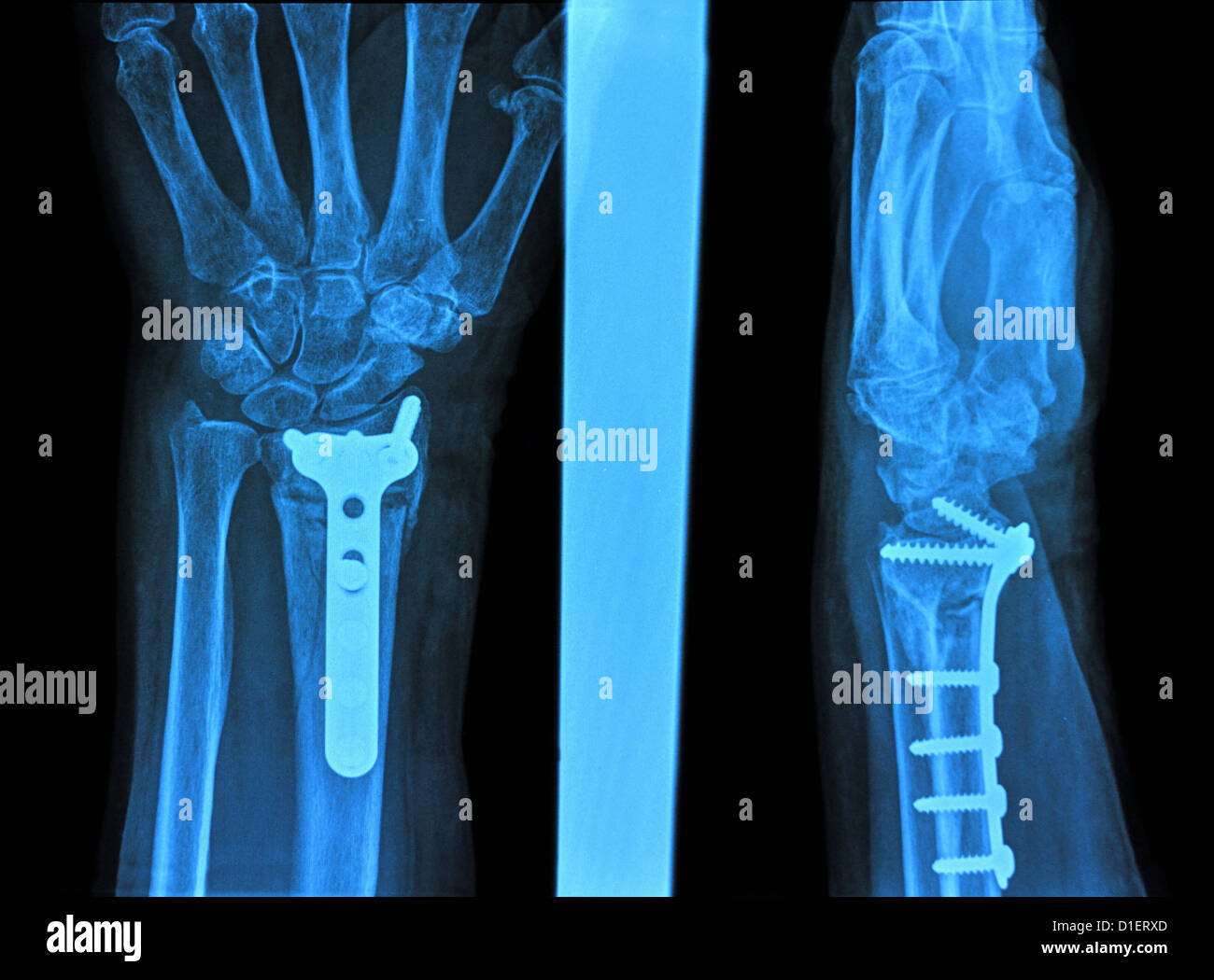 Medizinische-Bildhintergrund Hand xray Stockfoto