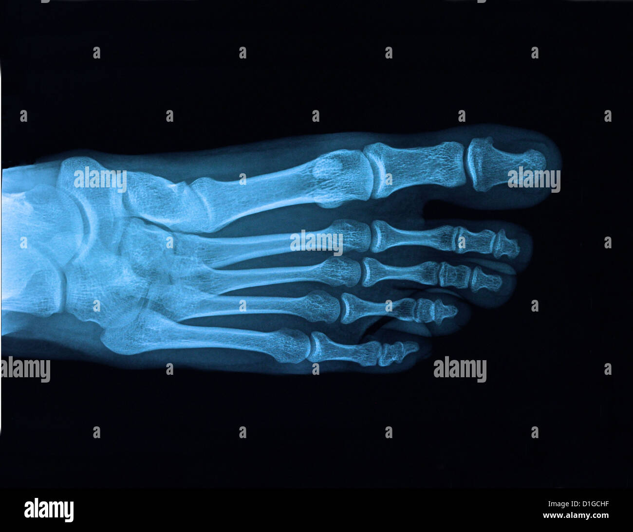 XRAY Fuß Stockfoto