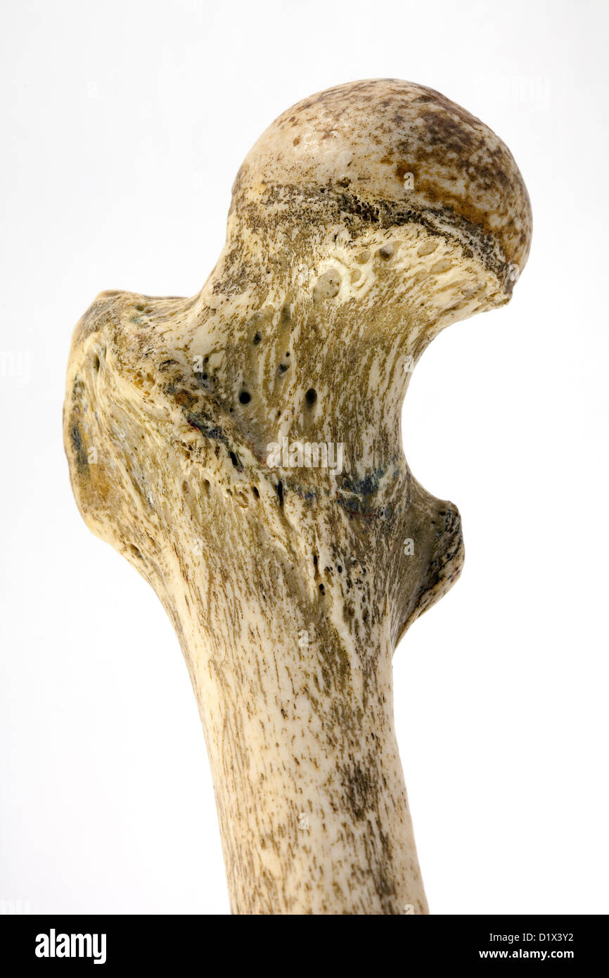 Menschlichen Oberschenkelknochen, schließen bis zu zeigen den Hals des Femur, die häufigste Bereich zum Bruch im Herbst, rechten Oberschenkelknochen, Ansicht von ventral Stockfoto