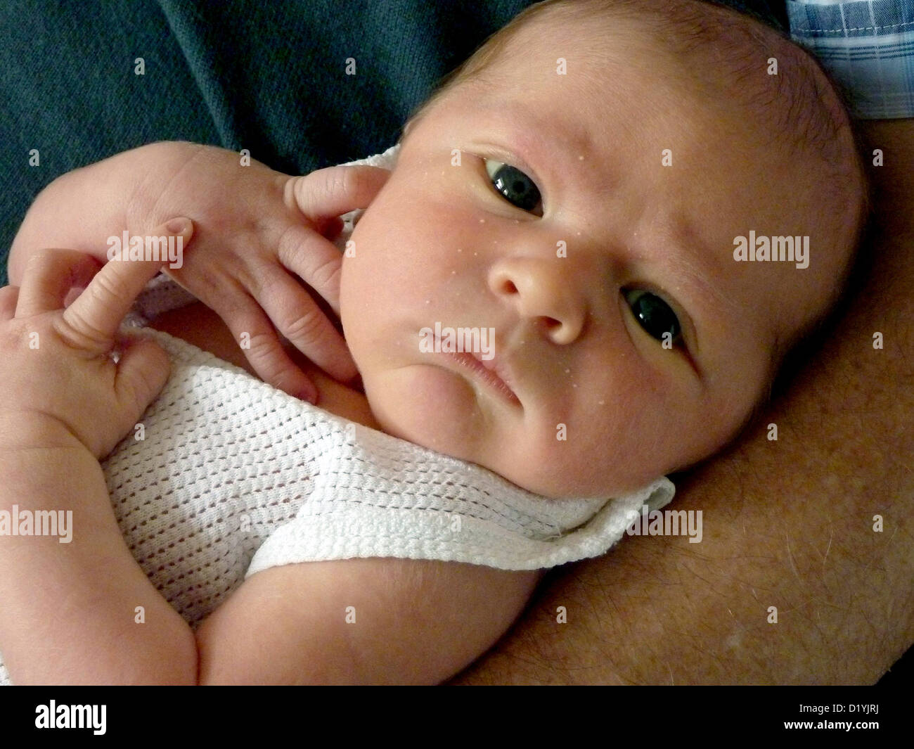 Tag 5 der Neugeborene mit Milch Flecken im Gesicht Stockfoto