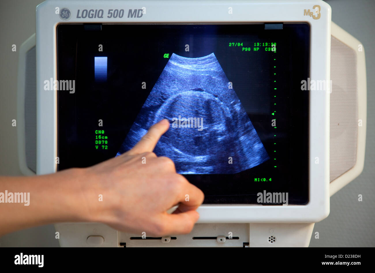 Essen, Deutschland, Ultraschalluntersuchung einer schwangeren Frau Stockfoto