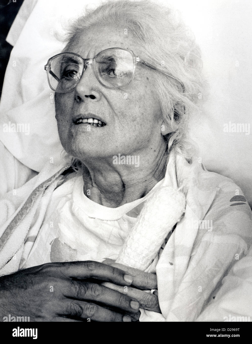 Frau im Krankenhausbett (Alzheimer-Patient) Stockfoto