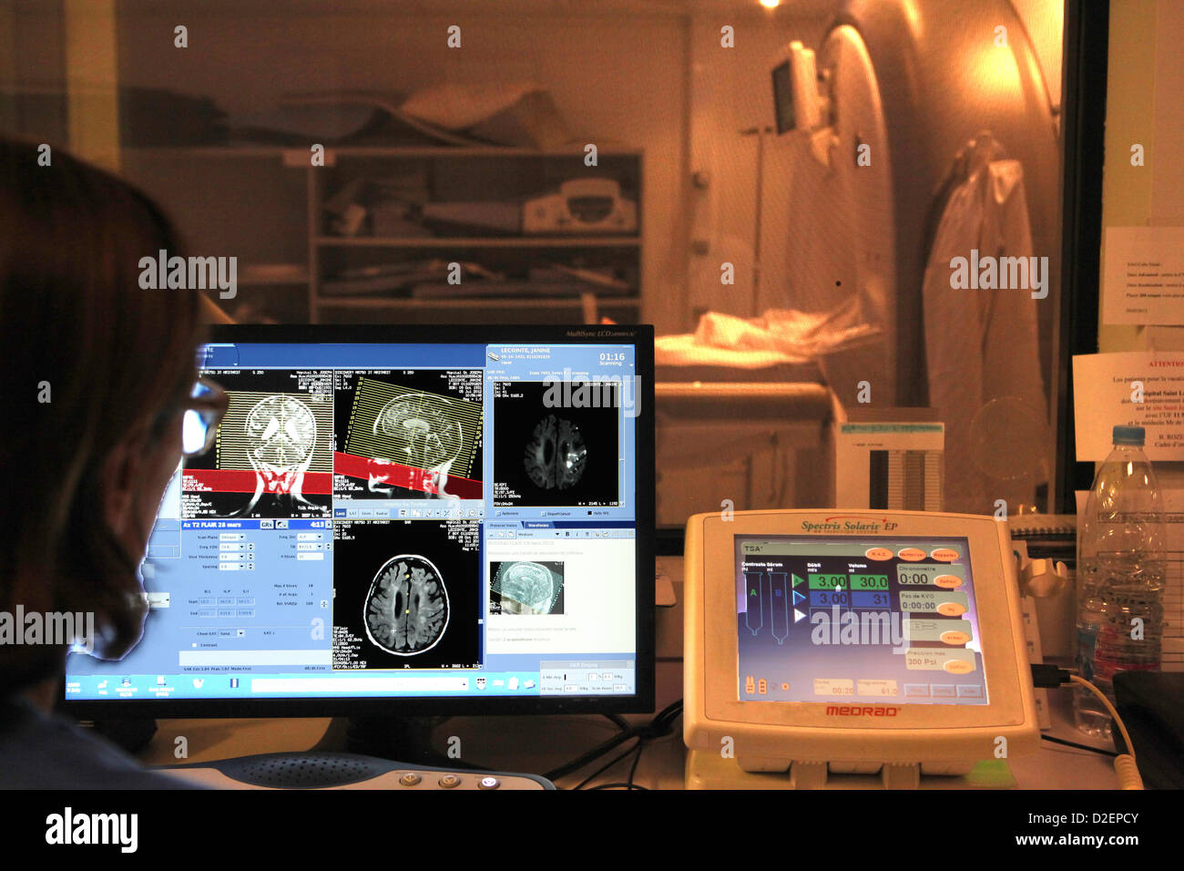 Reportage im St. Joseph Hospital in Paris, Frankreich. MRI Scan eine Apoplexie (Schlaganfall). Stockfoto