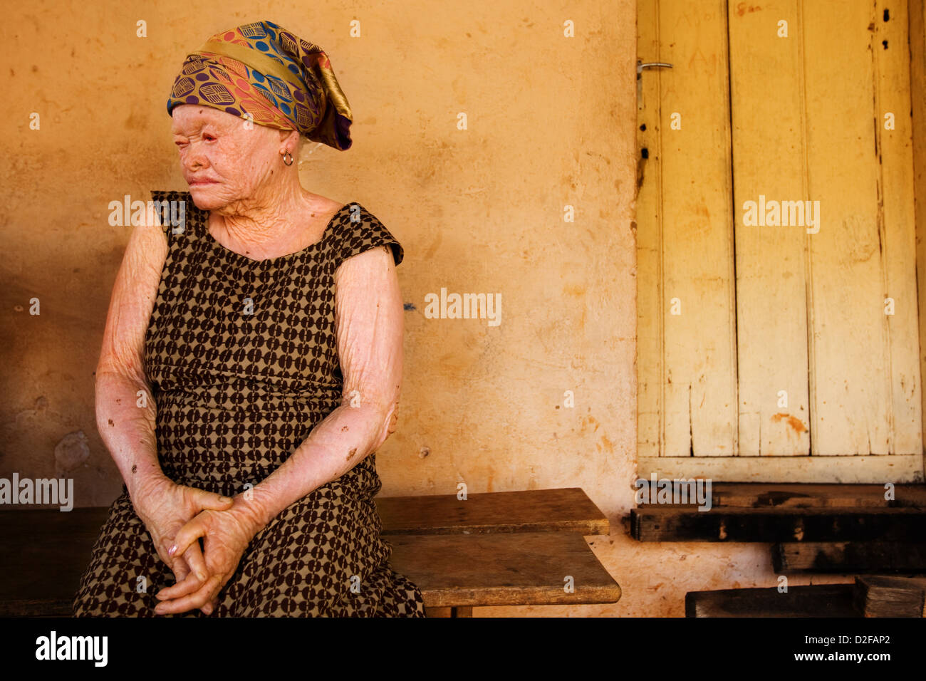 Porträt von älteren Albino-Frau. Stockfoto