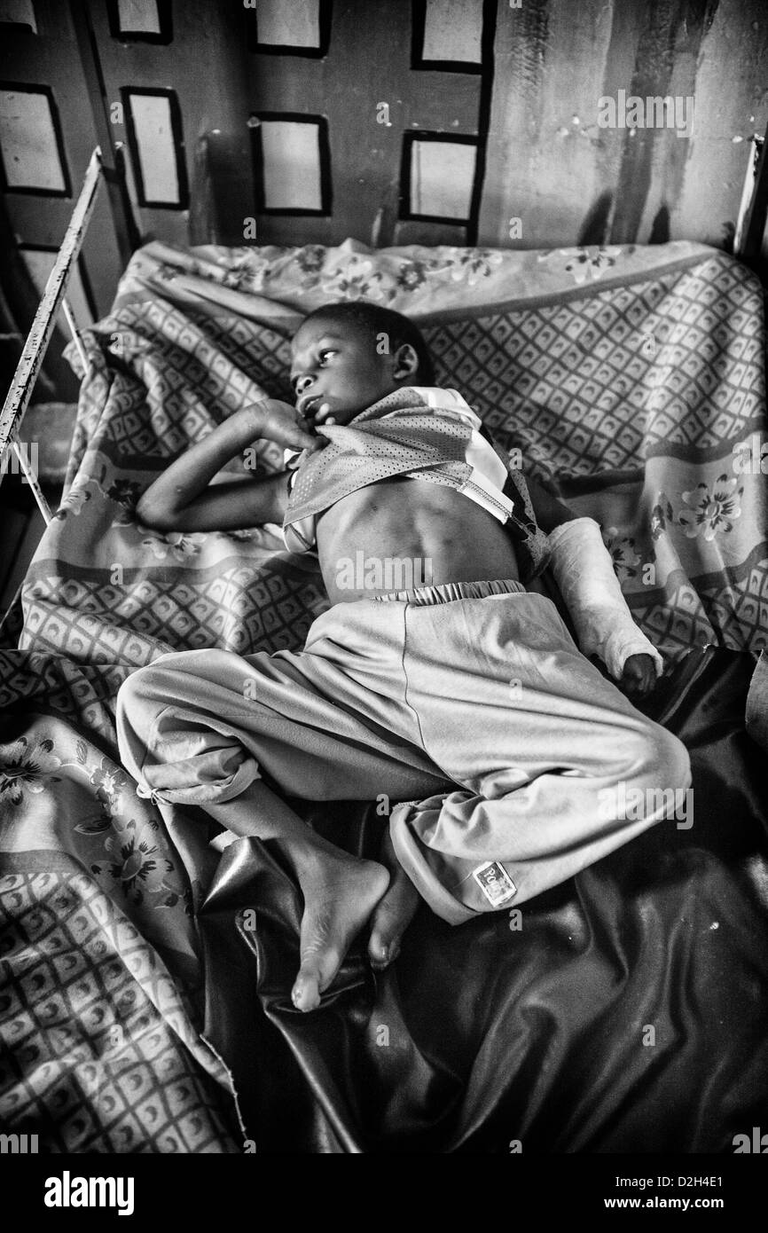 Ein Waisenjunge mit einem gebrochenen Arm liegt auf einem Bett zu St. Kizito Babyhaus. Stockfoto