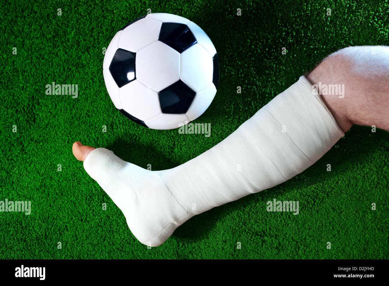 Fußballspieler mit gebrochenem Bein. Stockfoto