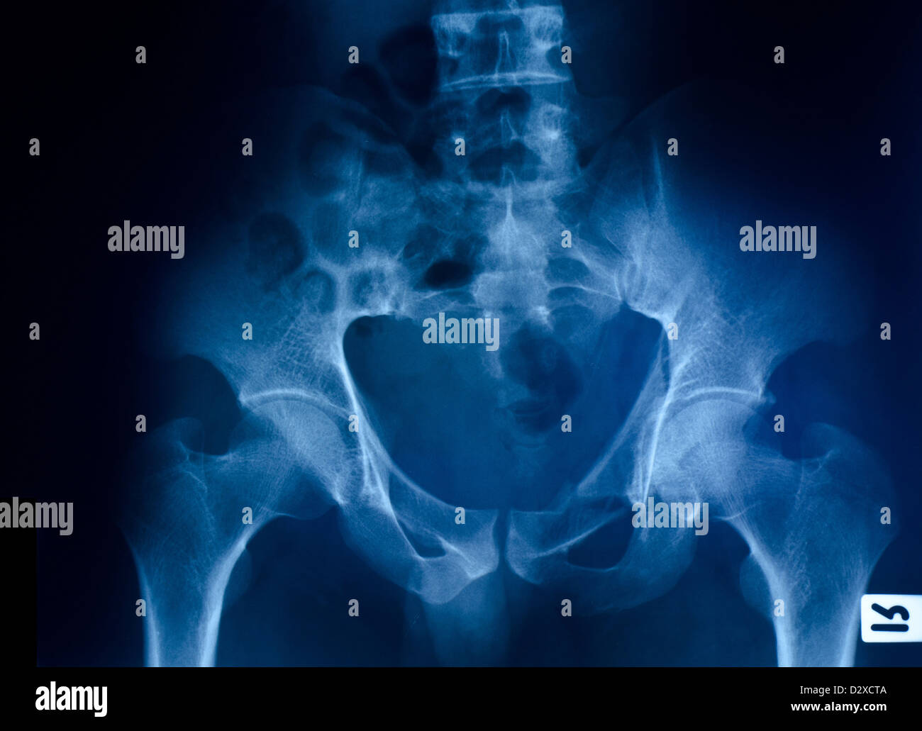 Pelvic examination -Fotos und -Bildmaterial in hoher Auflösung – Alamy
