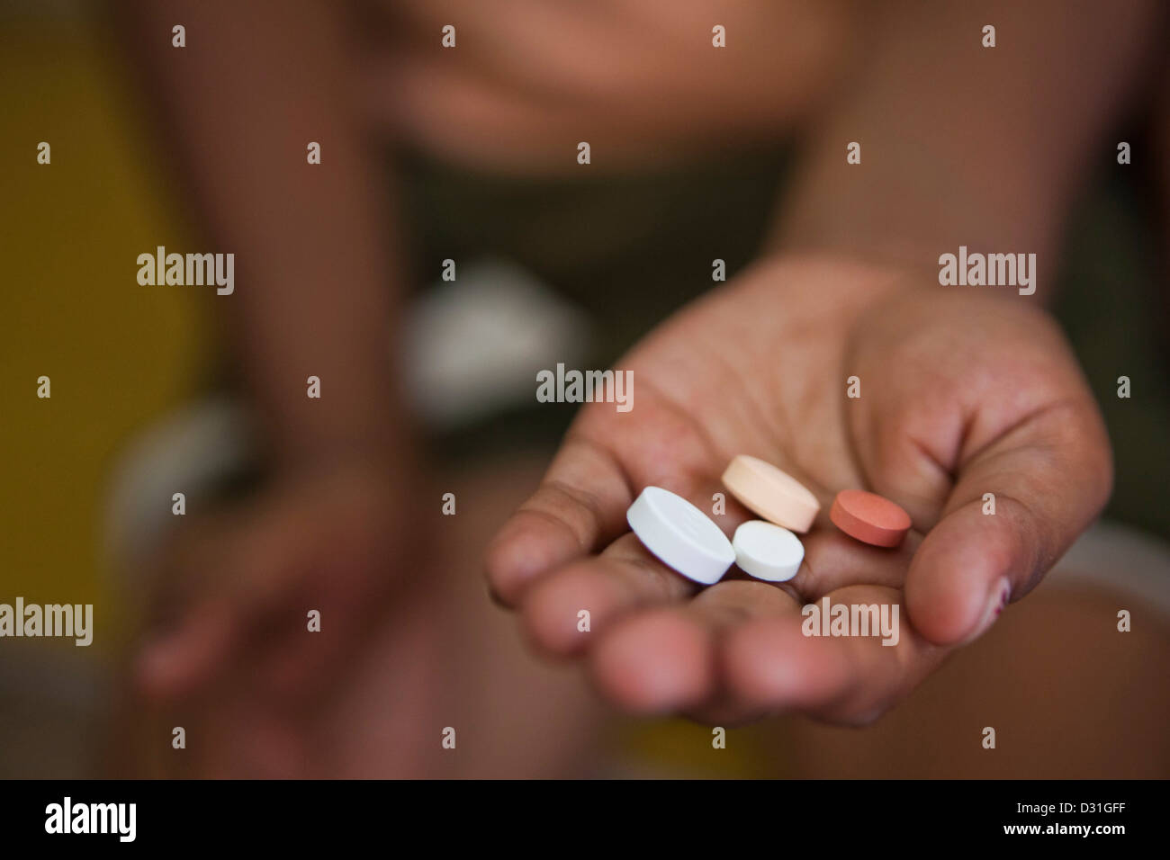 Indisches Kind erhält ihre täglichen Medikamente Tabletten für Tuberkulose (TB), die sind verzichtet wird. Delhi, Indien Stockfoto