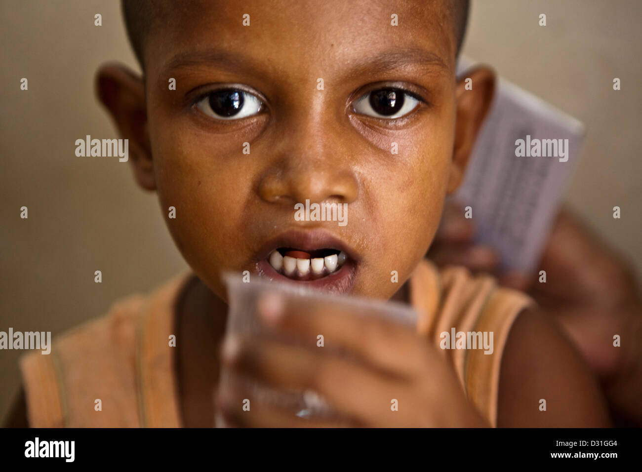 Indisches Kind erhält ihre täglichen Medikamente Tabletten für Tuberkulose (TB), die sind verzichtet wird. Delhi, Indien. Stockfoto