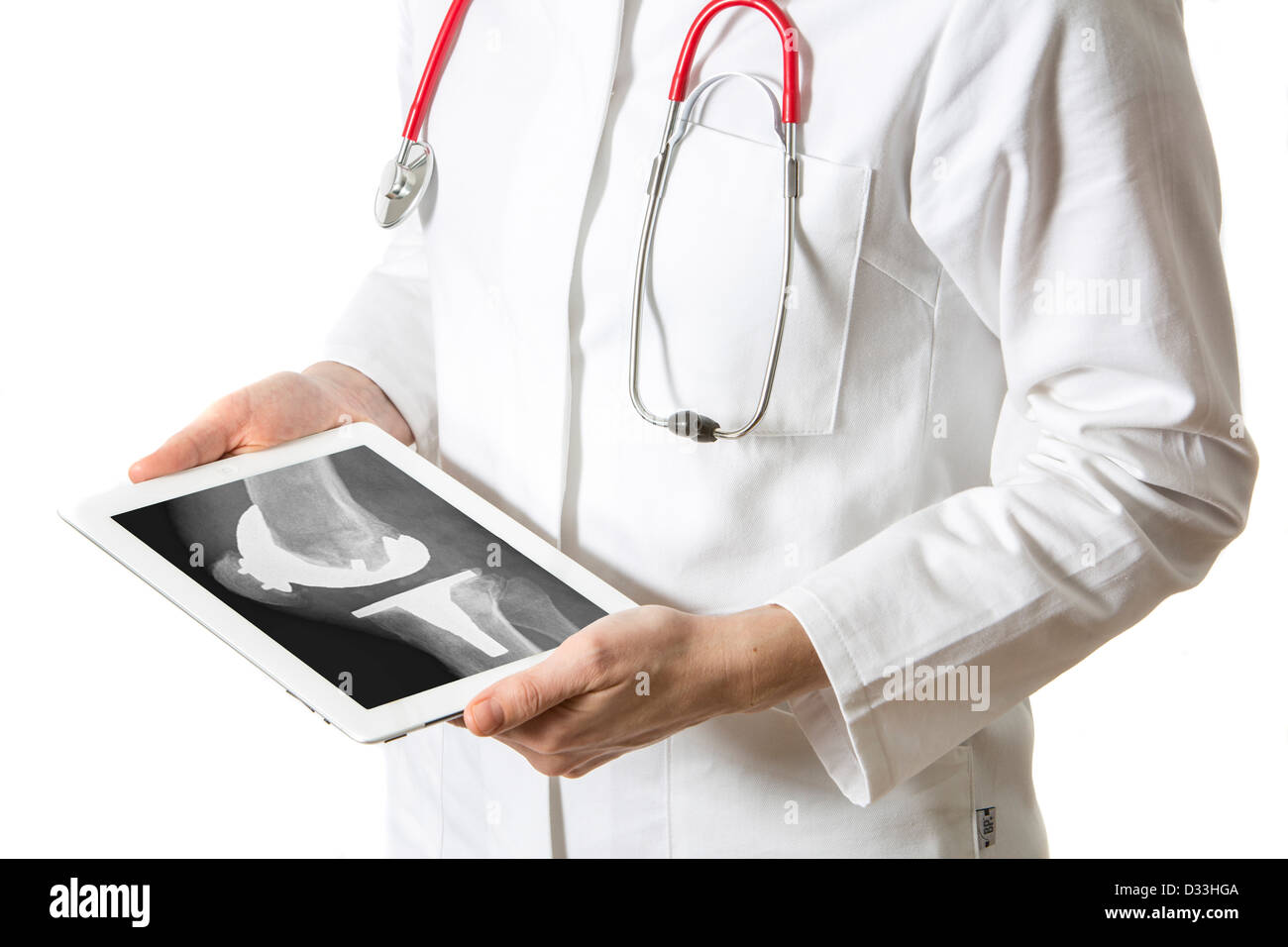 Symbolisches Bild Medizin. Arzt ist einen Tablet-Computer Ipad verwenden. Röntgenbild der ein künstliches Knie. Stockfoto
