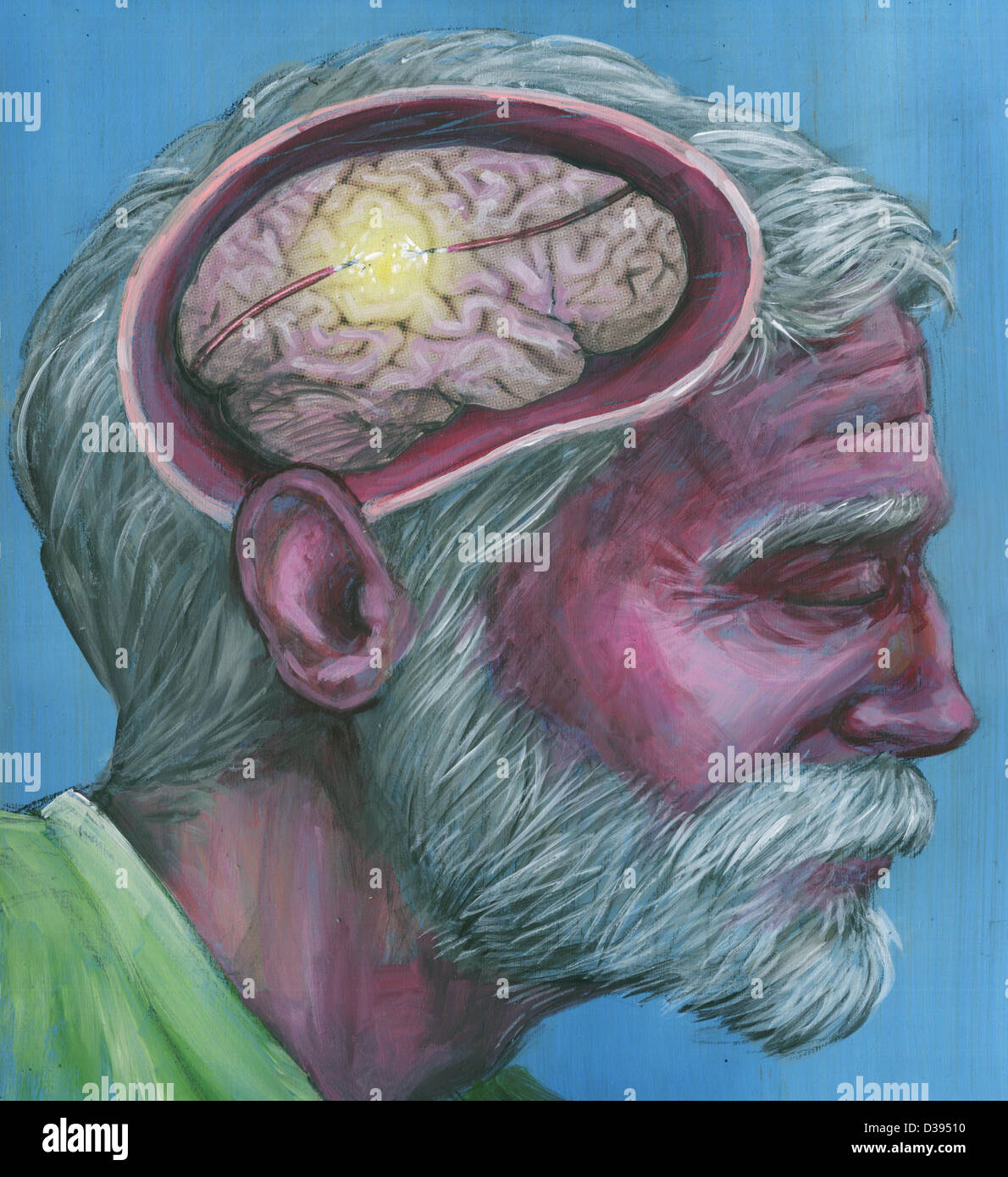Abbildung Schuss des älteren Menschen mit Alzheimer-Krankheit Stockfoto