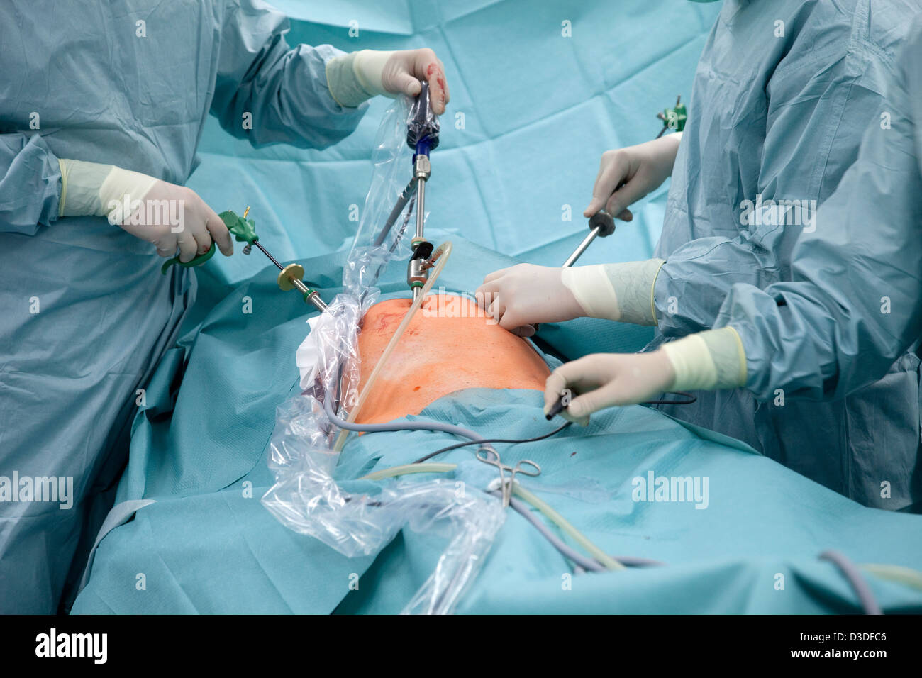 Deutschland, Krankenhaus, minimal-invasive Chirurgie in der Bauchhöhle Stockfoto