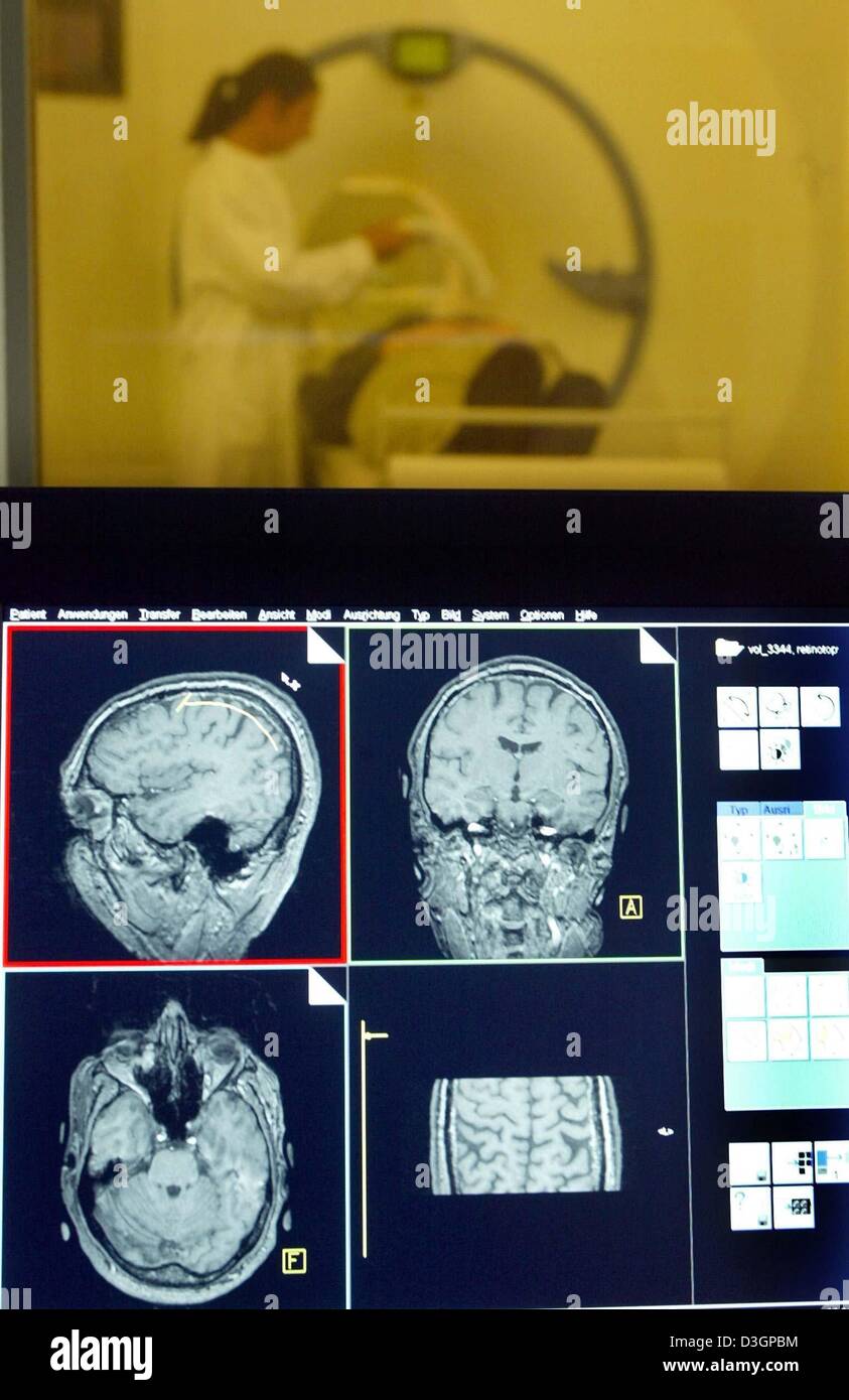 (Dpa) - ist ein Mitarbeiter (Hintergrund) für eine MRT-Untersuchung bei der Forschung Gruppe "Magnetresonanz (MR) Forschung in der Neurologie und Psychiatrie" an der Universitätsklinik in Göttingen, 20. Januar 2004 vorbereitet. Im Vordergrund sind Querschnitt-Bilder des Gehirns auf einem Bildschirm gesehen. Der Roman MRI-Scan-Technik hilft, neue Einblicke in die neurologischen und psychiatrischen Erkrankungen zu finden Stockfoto