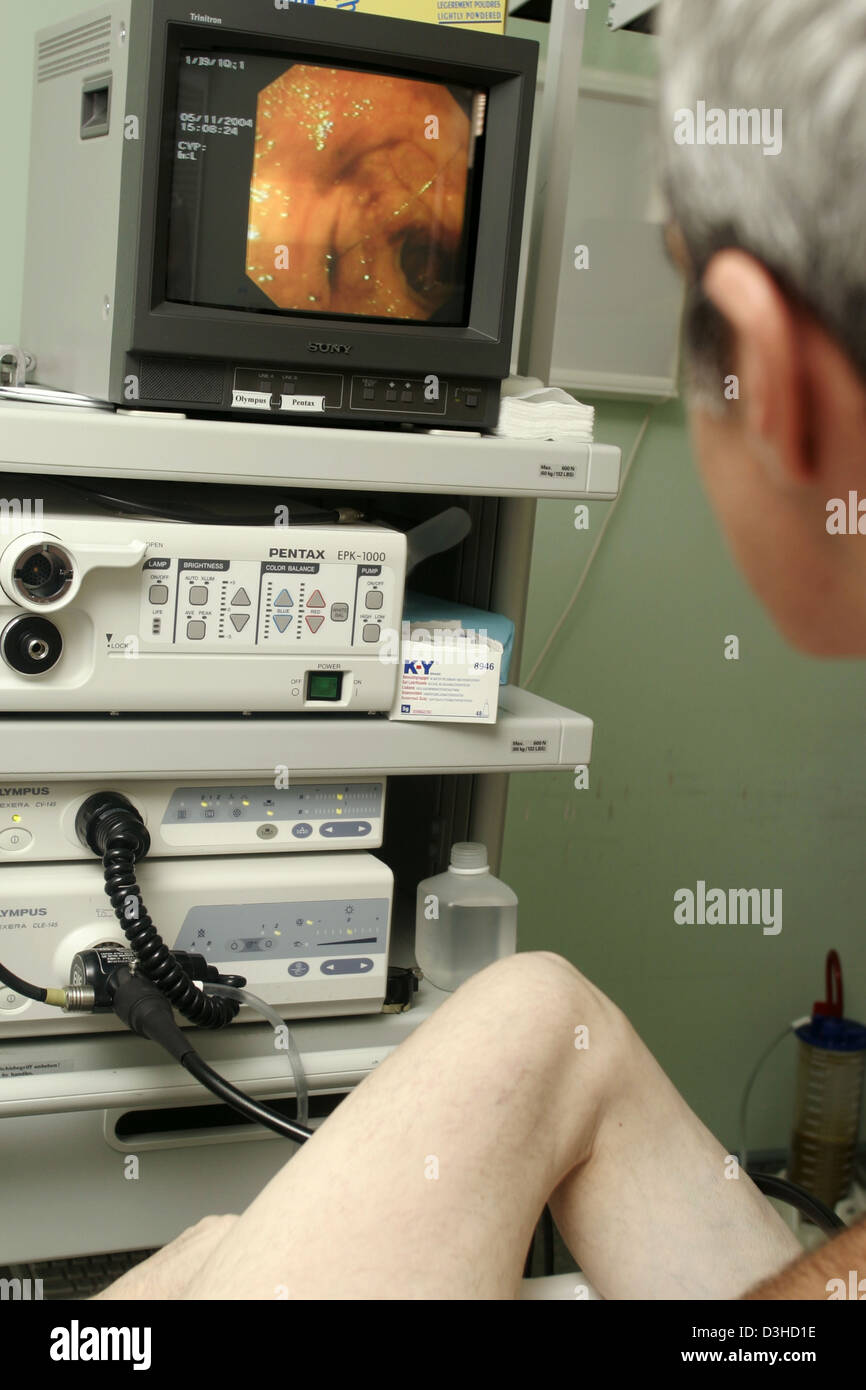 COLON, ENDOSKOPIE-UNTERSUCHUNG Stockfoto