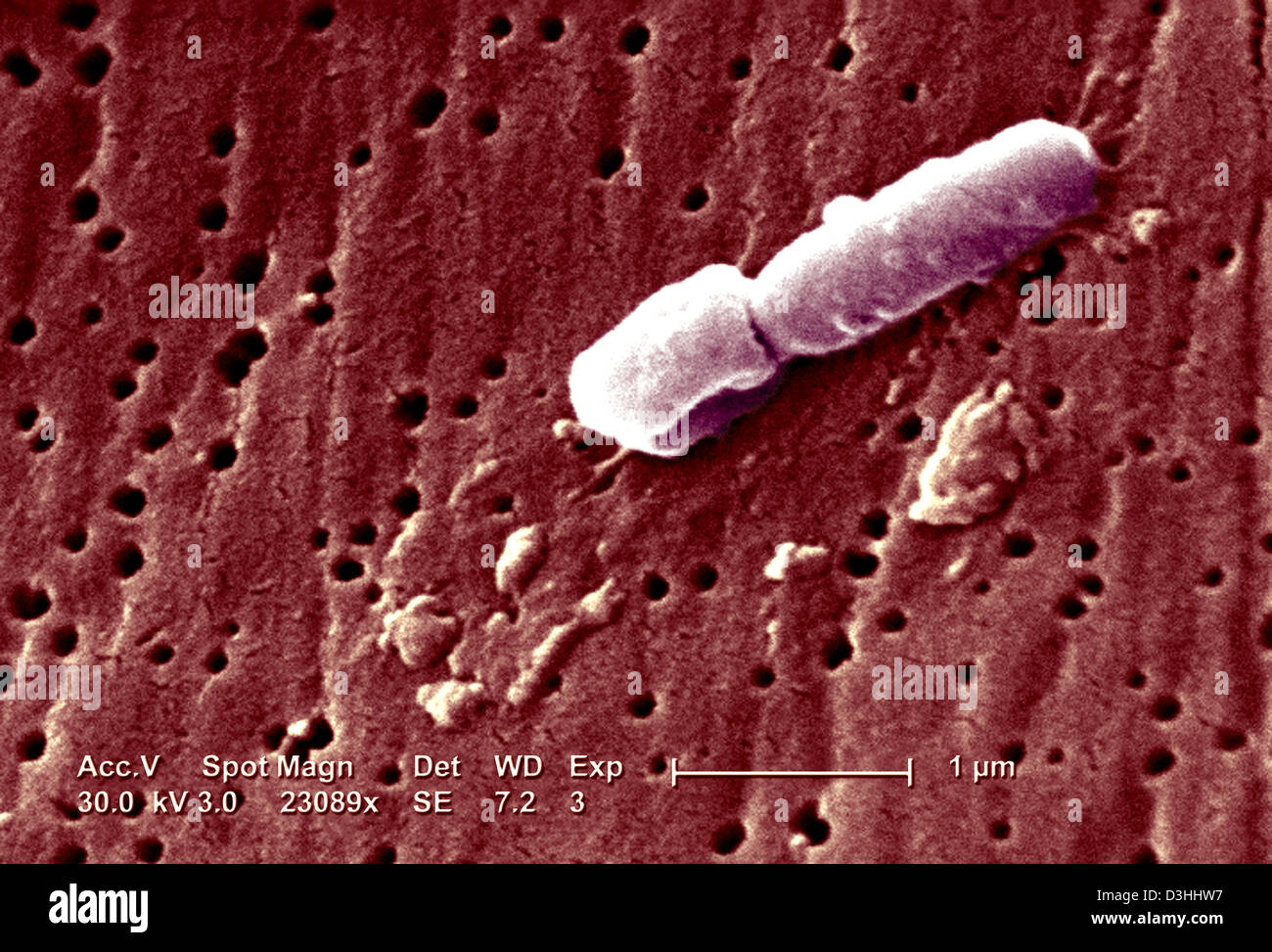 Klebsiella pneumoniae -Fotos und -Bildmaterial in hoher Auflösung – Alamy
