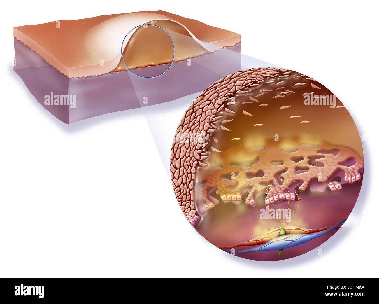 PHLYCTENA, ZEICHNUNG Stockfoto