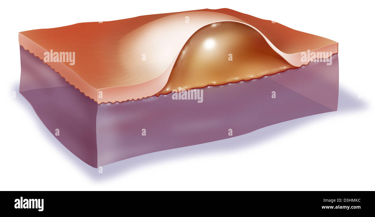 PHLYCTENA, ZEICHNUNG Stockfoto