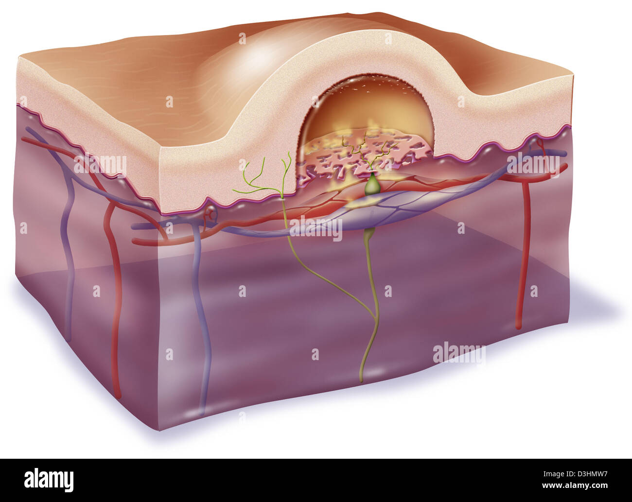 PHLYCTENA, ZEICHNUNG Stockfoto