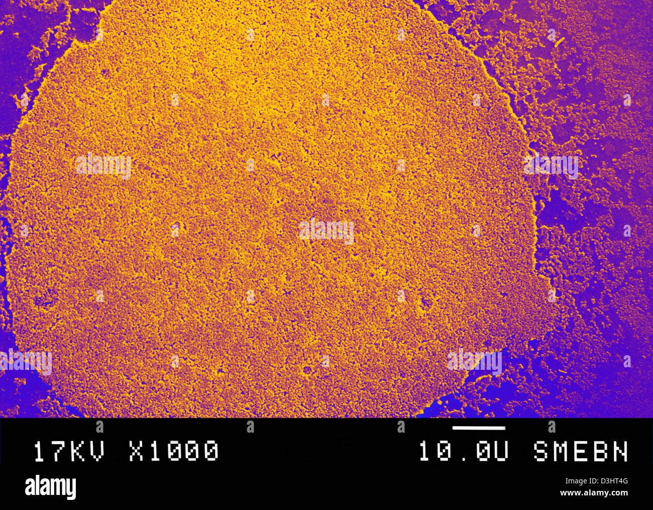 Mycoplasma hominis Fotos und Bildmaterial in hoher Auflösung Alamy