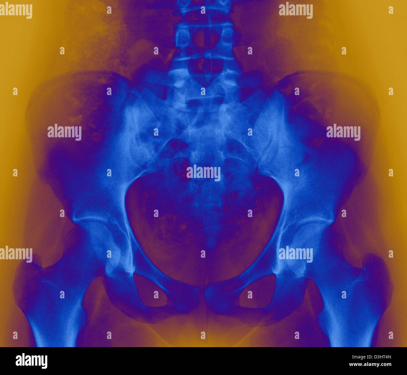 Pelvic Exam Stockfotos und -bilder Kaufen - Alamy