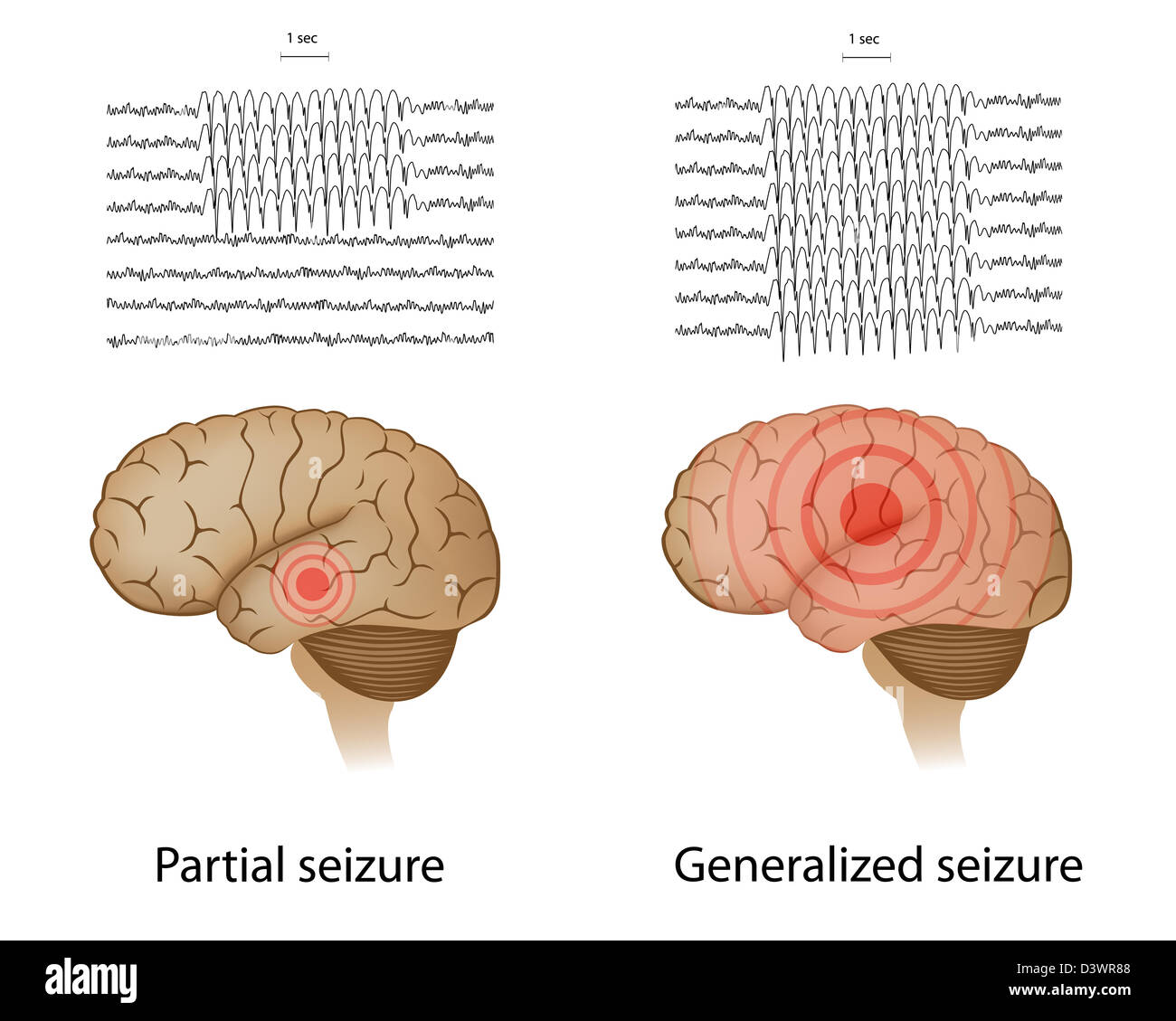 Eeg Ausgeschnittene Stockfotos und -bilder - Alamy