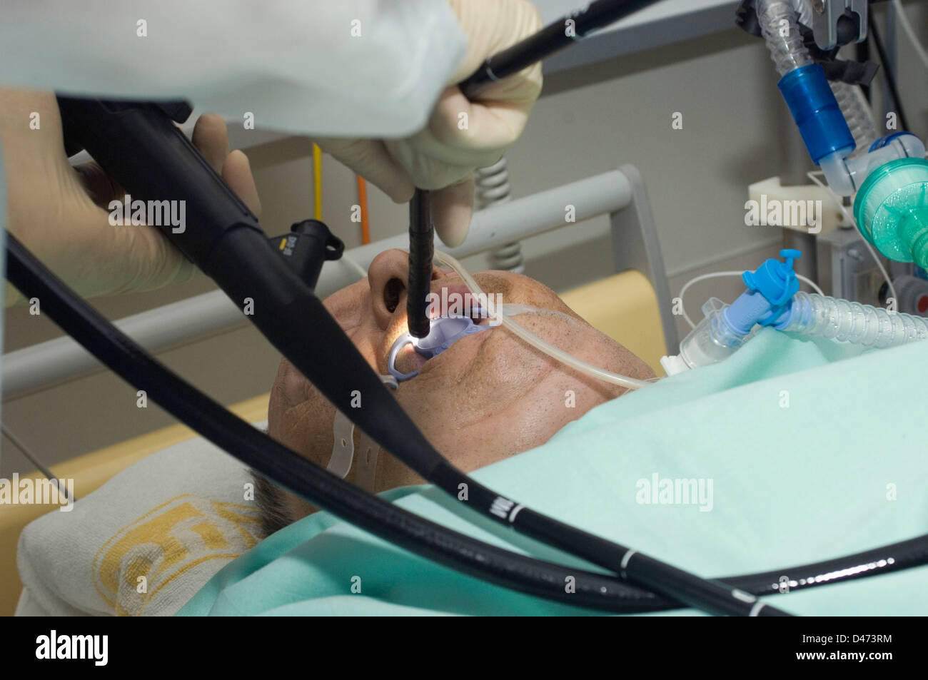 Einem Patienten eine endoskopische Verfahren mit der Sonde in den Mund, so dass Chirurgen, seine inneren Organe visuell zu prüfen. Stockfoto