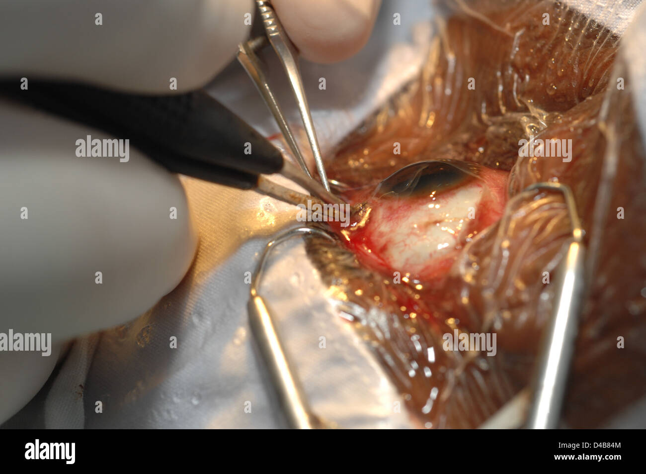 Konjunktivs hat Bewegung wieder Ausgangsstellung begonnen, so es Chirurgen während der Pars Plana Vitrektomie positioniert. Close-up Stockfoto