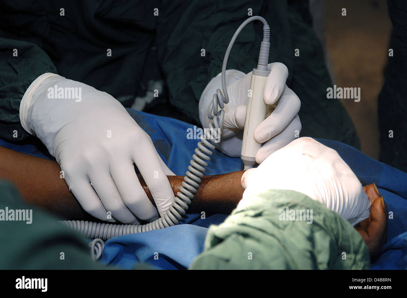 Chirurgen verwenden eine Karotis-Doppler Maschine für einen Impuls auf dem Arm eines Patienten während der Operation zu überprüfen. Sudan, Afrika. Stockfoto