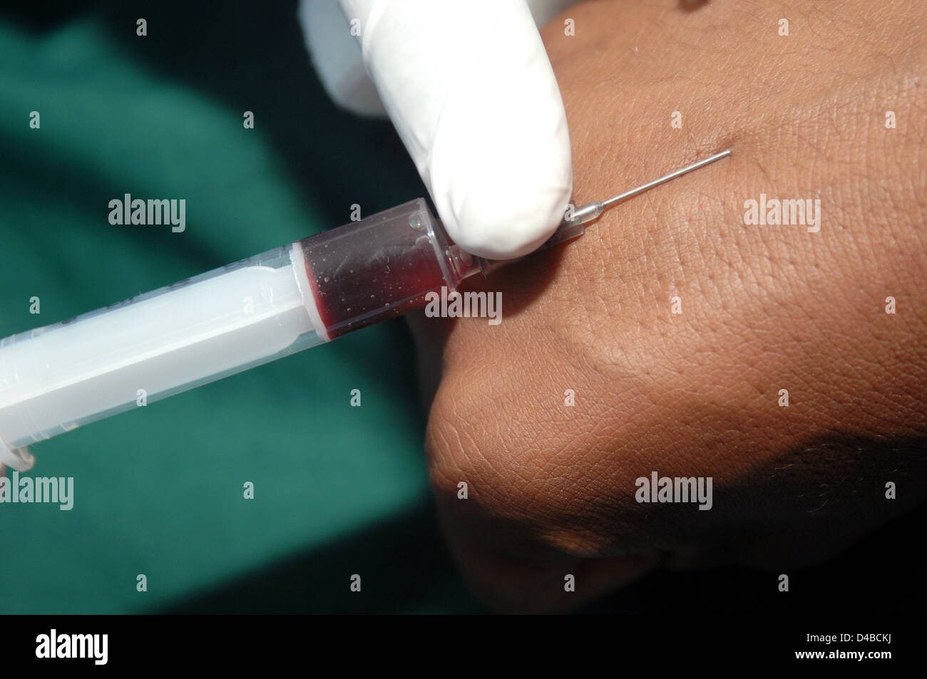 Vom Patienten wird eine Blutprobe entnommen. Sudan, Afrika. Stockfoto