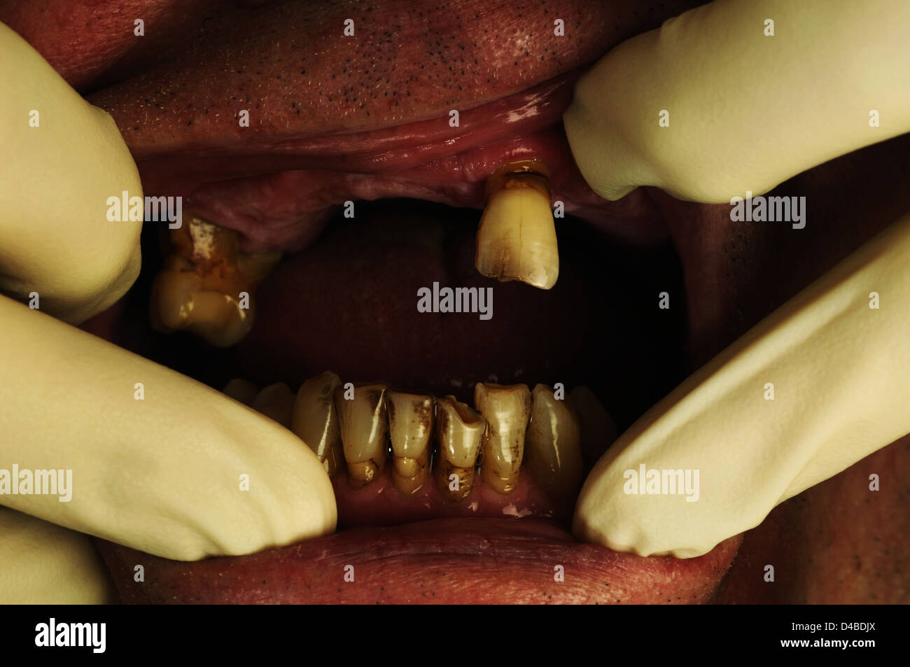 Mann mit Zähnen von Zahnarzt kontrolliert Stockfoto