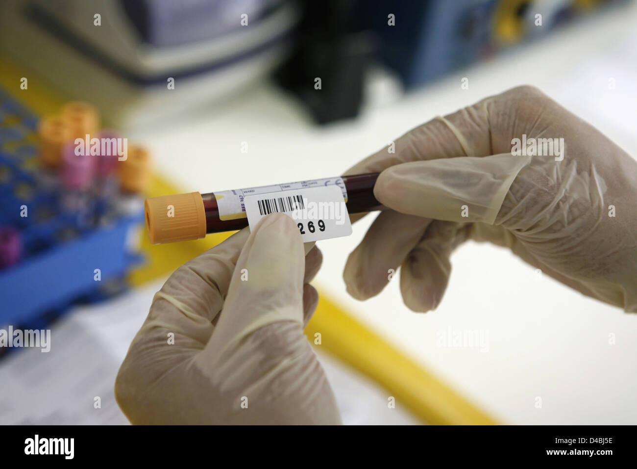 Pathologe Kennzeichnung Blutproben im Reagenzglas Stockfoto