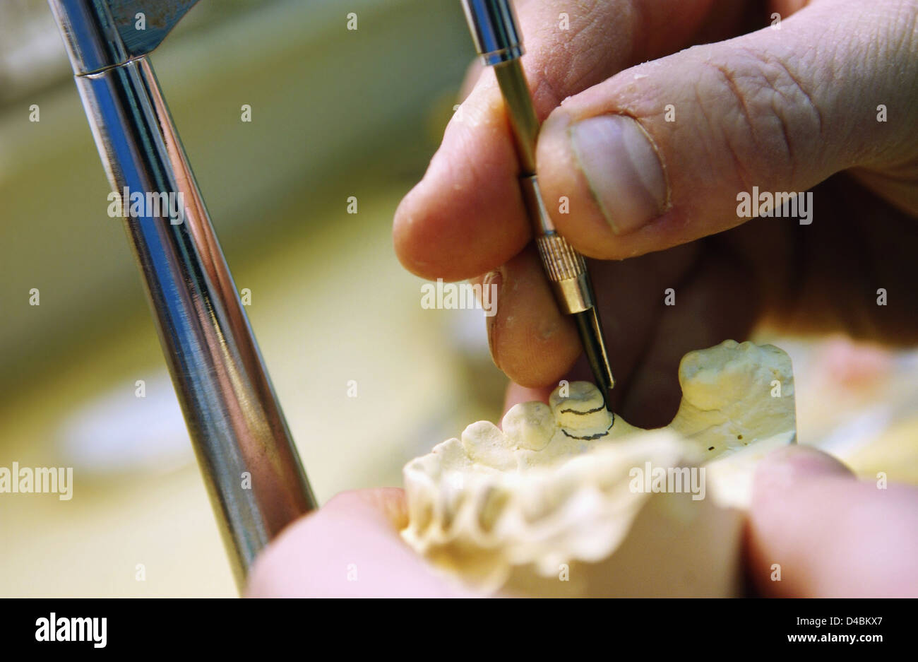 In Vorbereitung für die Herstellung von Zahnersatz dental gegossene abstecken Stockfoto