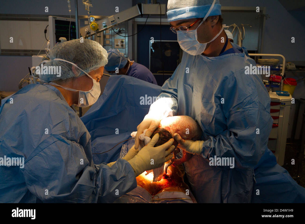 Kaiserschnitt in einem hospital.a Neugeborenen im OP-Saal Stockfoto