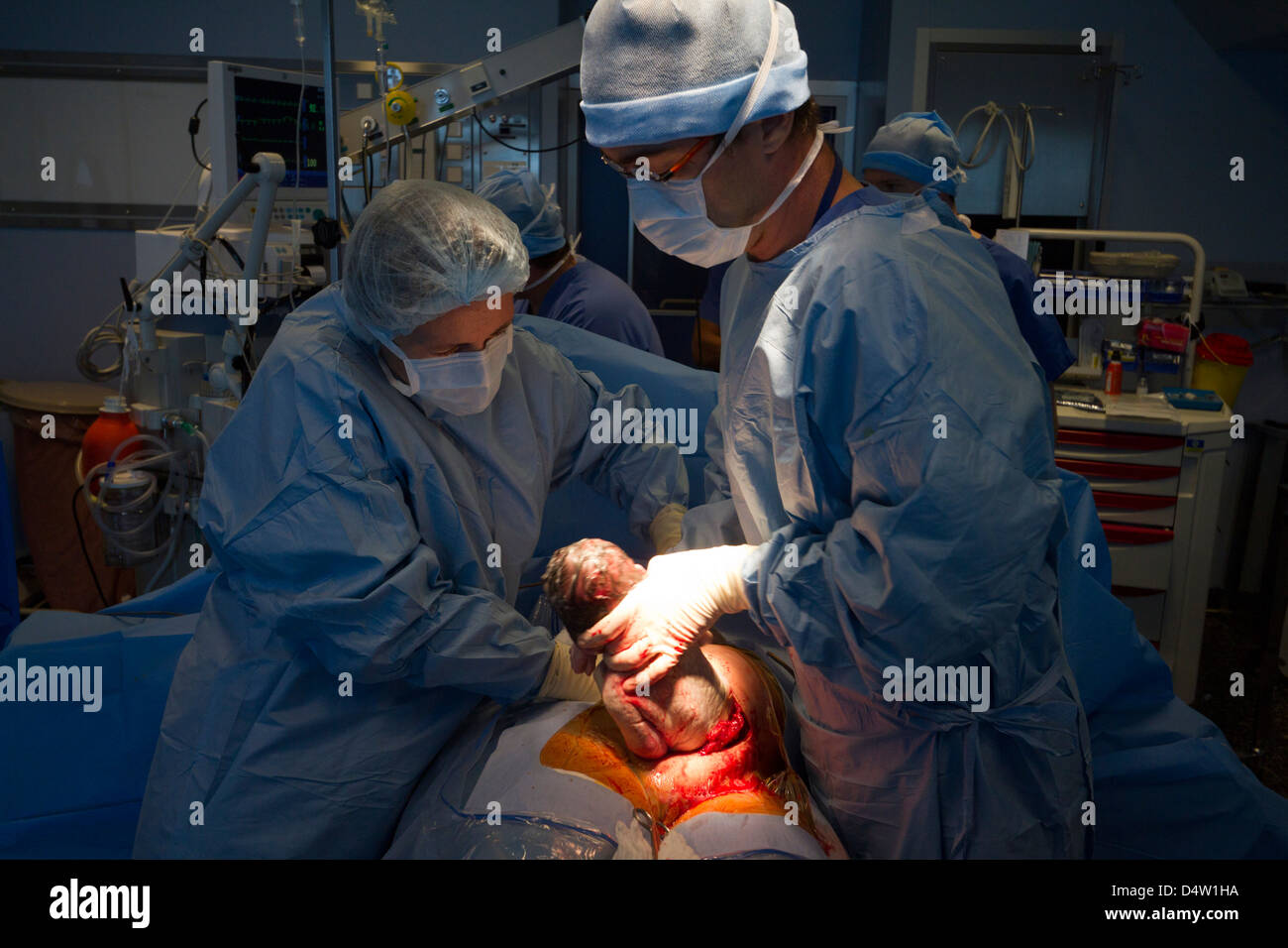 Kaiserschnitt in einem hospital.a Neugeborenen im OP-Saal Stockfoto