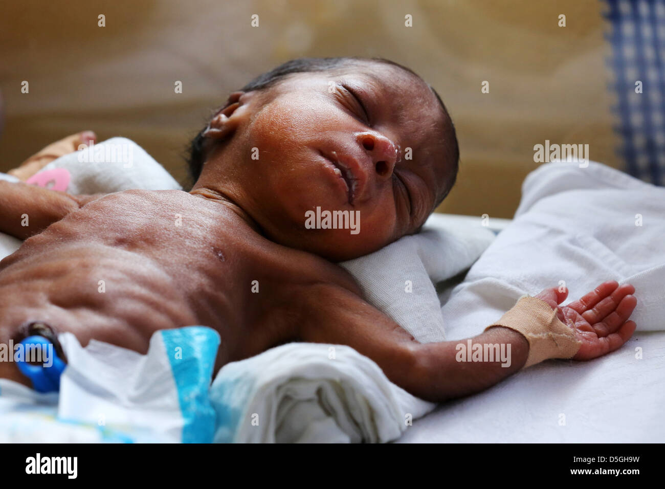 vorzeitigen Neugeborenen jungen im Bereich Mutterschaft der Heiligen Familie Krankenhaus in Techiman, Ghana Stockfoto
