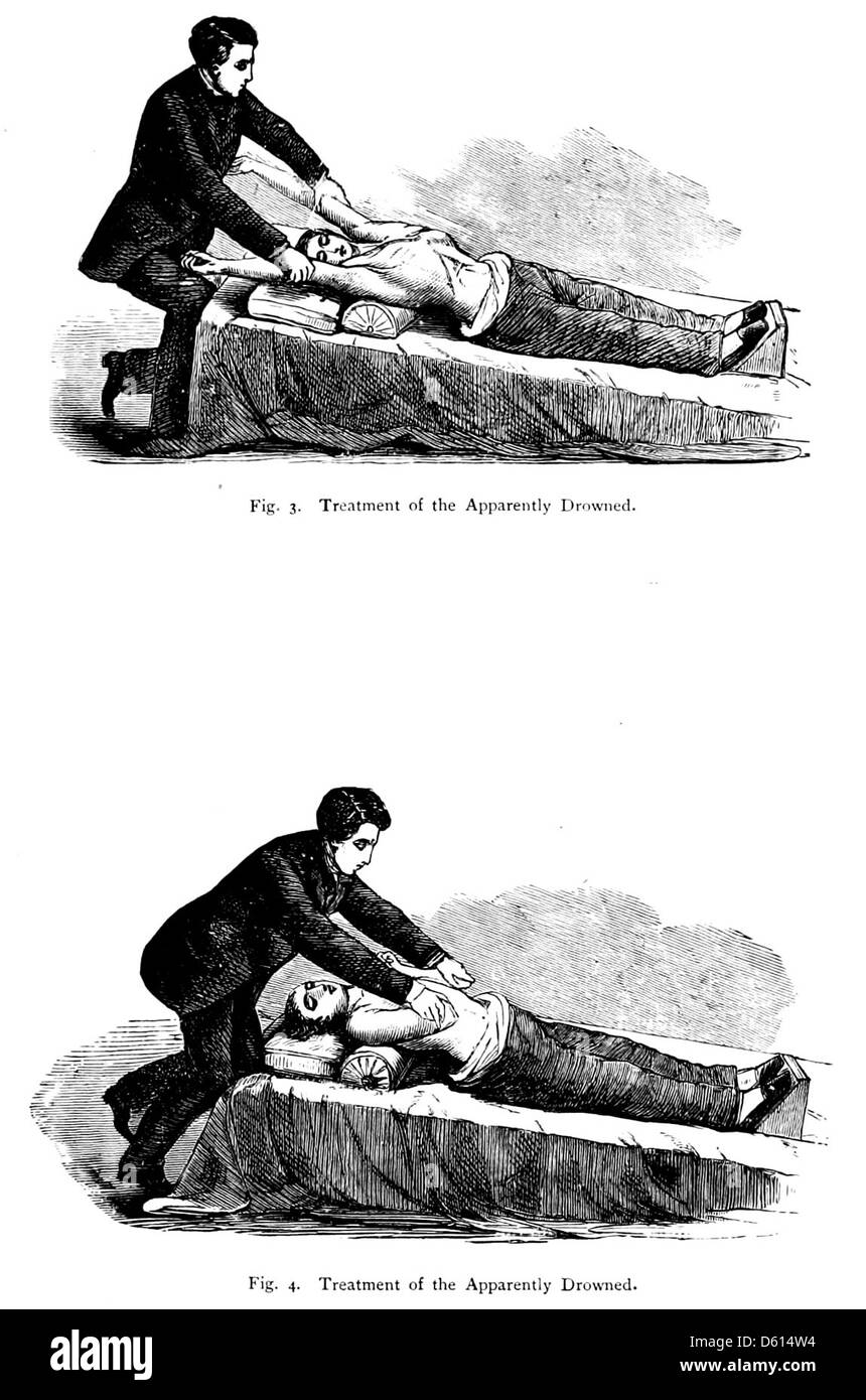Dieser Leitfaden von 1878, „A Domestic Cyclopædia of Practical Information“, enthält Anweisungen zur Notfallbehandlung beim Ertrinken. Das Buch soll dem Leser des 19. Jahrhunderts praktische Ratschläge zu häuslichen und medizinischen Notfällen bieten. Stockfoto