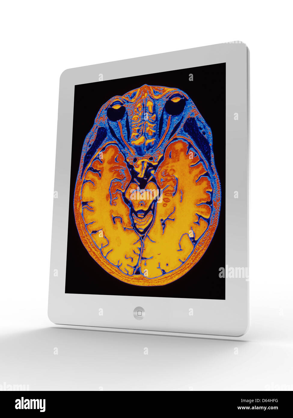 Tablet-Computer zeigen MRI Gehirn-scan Stockfoto